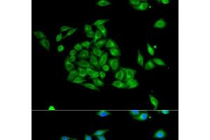 Immunofluorescence analysis of HeLa cells using PICK1 Polyclonal Antibody (PICK1 Antikörper)