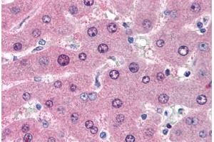Human Liver (formalin-fixed, paraffin-embedded) stained with LIME1 antibody ABIN239826 at 10 ug/ml followed by biotinylated anti-mouse IgG secondary antibody ABIN481714, alkaline phosphatase-streptavidin and chromogen. (LIME Antikörper  (AA 281-296))