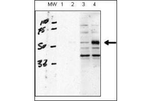 human chondrocytes (C28/I2 cells), transfected with empty vector (lane 1, 3) or ACVRL1(lane 2, 4). (ACVRL1 Antikörper  (N-Term))