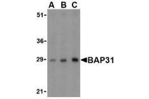 Western blot analysis of BAP31 in rat lung tissue lysate with AP30124PU-N BAP31 antibody at (A) 0. (BCAP31 Antikörper  (Intermediate Domain))