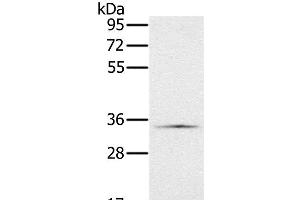 Western Blot analysis of Hela cell using NDUFA9 Polyclonal Antibody at dilution of 1:400 (NDUFA9 Antikörper)