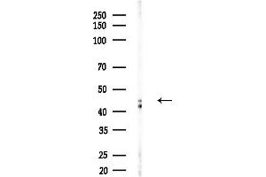 Western blot analysis of lysates from Hela cells(heat-shock,45 min treatment), using Vitamin D Receptor Antibody at 1/1000 dilution.
