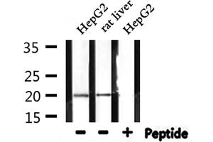 Western blot analysis of extracts from HepG2 and rat liver, using RPL27A Antibody. (RPL27A Antikörper  (C-Term))
