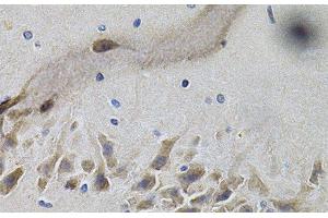 Immunohistochemistry of paraffin-embedded Mouse brain using NTRK1 Polyclonal Antibody at dilution of 1:100 (40x lens). (TRKA Antikörper)