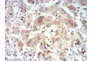 Immunohistochemistry (IHC) image for anti-PR Domain Containing 4 (PRDM4) (AA 476-575) antibody (ABIN5874480) (PRDM4 Antikörper  (AA 476-575))