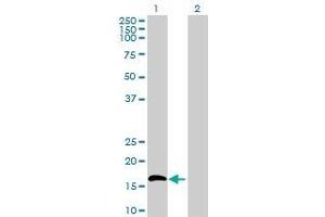 Western Blotting (WB) image for IL15 293T Cell Transient Overexpression Lysate(Denatured) (ABIN1332360)