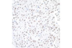 Immunohistochemistry (IHC) image for anti-Actin-Like 6A (BAF53A) (AA 25-75) antibody (ABIN7453898) (BAF53A Antikörper  (AA 25-75))