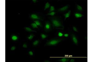 Immunofluorescence of monoclonal antibody to STAT5B on HeLa cell. (STAT5B Antikörper  (AA 678-787))