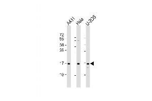 Western Blot at 1:2000 dilution Lane 1: A431 whole cell lysate Lane 2: Hela whole cell lysate Lane 3: U-2OS whole cell lysate Lysates/proteins at 20 ug per lane. (RPLP1 Antikörper  (AA 18-49))