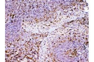 Immunohistochemistry (IHC) image for anti-Adenosine Deaminase (ADA) (AA 2-238) antibody (ABIN5708187)