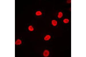 Immunofluorescent analysis of hnRNP F staining in Jurkat cells. (HNRNPF Antikörper  (N-Term))