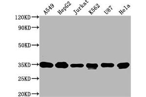 Western Blot Positive WB detected in: A549 whole cell lysate, HepG2 whole cell lysate, Jurkat whole cell lysate, K562 whole cell lysate, U87 whole cell lysate, Hela whole cell lysate All lanes: SUMF2 antibody at 1:2000 Secondary Goat polyclonal to rabbit IgG at 1/50000 dilution Predicted band size: 34, 25, 38, 24, 35 kDa Observed band size: 34 kDa (SUMF2 Antikörper  (AA 26-301))