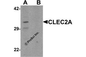 Western Blotting (WB) image for anti-C-Type Lectin Domain Family 2, Member A (CLEC2A) (N-Term) antibody (ABIN1031323)