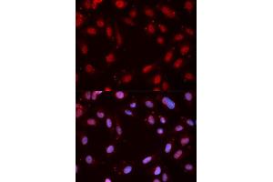 Immunofluorescence analysis of MCF-7 cells using Phospho-CHEK1-S280 antibody (ABIN5969878). (CHEK1 Antikörper  (pSer280))