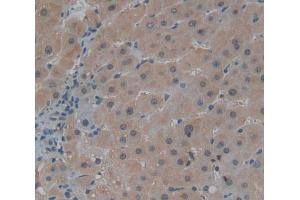 Used in DAB staining on fromalin fixed paraffin- embedded liver tissue (Centriolin Antikörper  (AA 2101-2325))