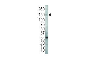 VEGFR2/CD309 Antikörper  (C-Term)