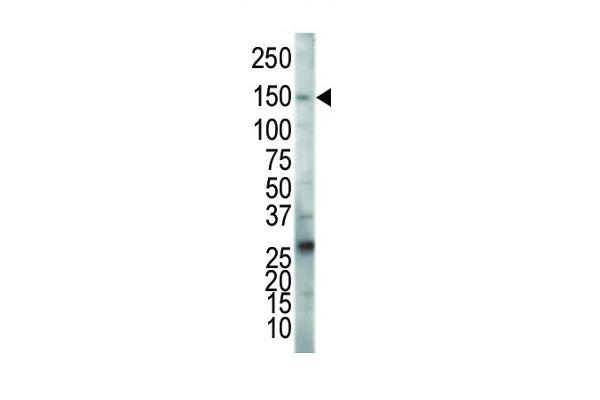 VEGFR2/CD309 antibody  (C-Term)