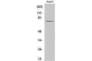 Western Blotting (WB) image for anti-CAP-GLY Domain Containing Linker Protein Family, Member 4 (CLIP4) (Internal Region) antibody (ABIN3183959)