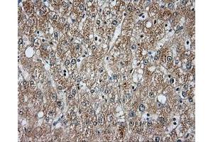 Immunohistochemical staining of paraffin-embedded liver tissue using anti-BTK mouse monoclonal antibody. (BTK Antikörper)