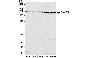 anti-CCR4-NOT Transcription Complex, Subunit 1 (CNOT1) (AA 1400-1450) antibody