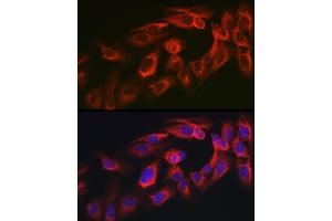 Immunofluorescence analysis of U2OS cells using MYO10 antibody (ABIN6128319, ABIN6144271, ABIN6144274 and ABIN6216113) at dilution of 1:350. (Myosin X Antikörper  (AA 845-944))