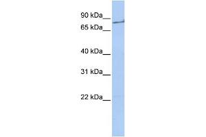 WB Suggested Anti-F2 Antibody  Titration: 1 ug/ml Positive Control: 721_B cell lysate (Prothrombin Antikörper  (Middle Region))