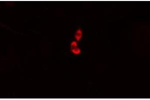 ABIN6274976 staining HepG2 cells by IF/ICC. (COMT Antikörper  (N-Term))