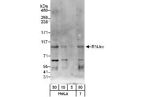 anti-USP6 N-terminal Like (USP6NL) (AA 350-400) antibody