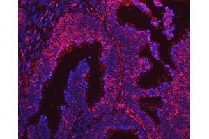 IF analysis of ARL1 using anti-ARL1 antibody (ABIN7602848). (ARL1 Antikörper  (C-Term))