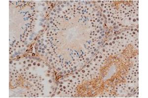 Immunohistochemistry (IHC) image for anti-Jun D Proto-Oncogene (JUND) (pSer255) antibody (ABIN6255135)