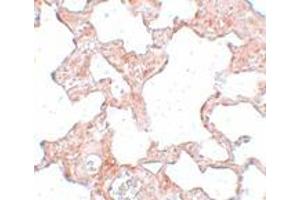 Immunohistochemistry (IHC) image for anti-Protein Kinase Domain Containing, Cytoplasmic Homolog (Mouse) (PKDCC) (Middle Region) antibody (ABIN1031161) (PKDCC Antikörper  (Middle Region))