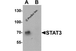 Western Blotting (WB) image for anti-Signal Transducer and Activator of Transcription 3 (Acute-Phase Response Factor) (STAT3) (N-Term) antibody (ABIN1077432) (STAT3 Antikörper  (N-Term))