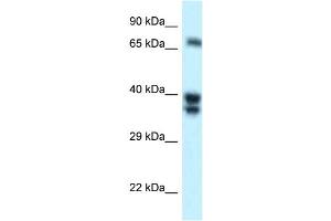 WB Suggested Anti-SH3BP1 Antibody Titration: 1.