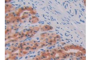 Immunohistochemistry (IHC) image for anti-Single Immunoglobulin and Toll-Interleukin 1 Receptor (TIR) Domain (SIGIRR) (AA 1-118) antibody (ABIN7437206)