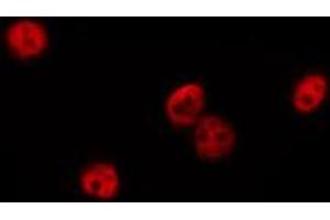 ABIN6274894 staining HepG2 by IF/ICC. (DQX1 Antikörper  (Internal Region))