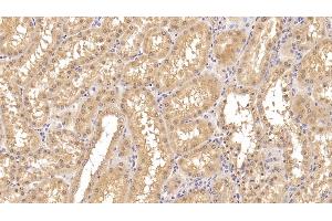 Immunohistochemistry (IHC) image for anti-Insulin Receptor (INSR) antibody (ABIN7427843)