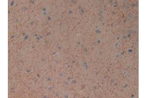 DAB staining on IHC-P; Samples: General Stomach Tissue)