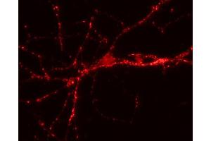 Immunofluorescence labeling of hippocampus neurons (dilution 1 : 500).
