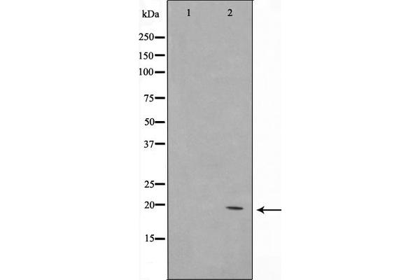 COX4I2 Antikörper  (Internal Region)