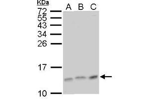Western Blotting (WB) image for anti-Mitogen-Activated Protein Kinase Kinase 1 Interacting Protein 1 (MAPKSP1) antibody (ABIN2856785)