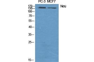 Western Blot (WB) analysis of specific cells using Neu Polyclonal Antibody. (NEURL Antikörper  (Ser354))