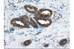 Immunohistochemical staining of paraffin-embedded Human Kidney tissue using anti-ACAT2 mouse monoclonal antibody. (ACAT2 Antikörper)