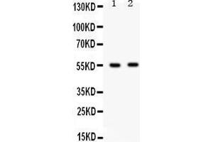 Observed bind size: 54KD (GABRB3 Antikörper  (C-Term))