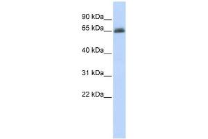 UGT2B15 antibody used at 1 ug/ml to detect target protein.