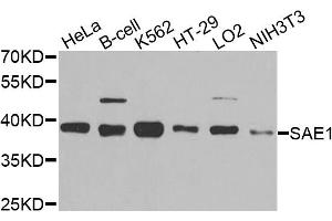 Western blot analysis of extracts of various cell lines, using SAE1 antibody. (SAE1 Antikörper)