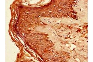 Immunohistochemistry of paraffin-embedded human skin tissue using ABIN7156631 at dilution of 1:100 (IRF7 Antikörper  (AA 131-289))