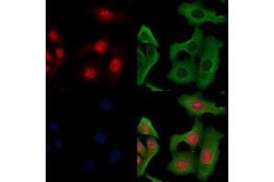 ABIN6264198 and ABIN6266655 staining Hela cells by IF/ICC. (PIAS3 Antikörper  (N-Term))