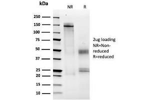 SDS-PAGE Analysis Purified MCM6 Mouse Monoclonal Antibody (MCM6/2999). (MCM6 Antikörper  (AA 228-368))