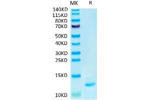 Human IL-15 on Tris-Bis PAGE under reduced condition. (IL-15 Protein)