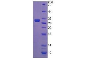 SDS-PAGE analysis of Chicken AMH Protein.